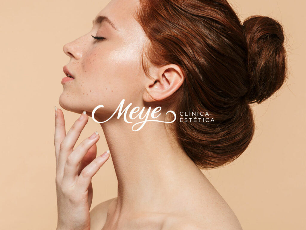 1.identidad_Meye